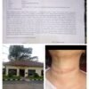 ROSDIANA TANJUNG KORBAN PENGANIAYAAN ,KELUARGA KORBAN MENGHARAPKAN AGAR POLISI SEGERA MENANGKAP YANG TERDUGA PELAKU TERSEBUT 